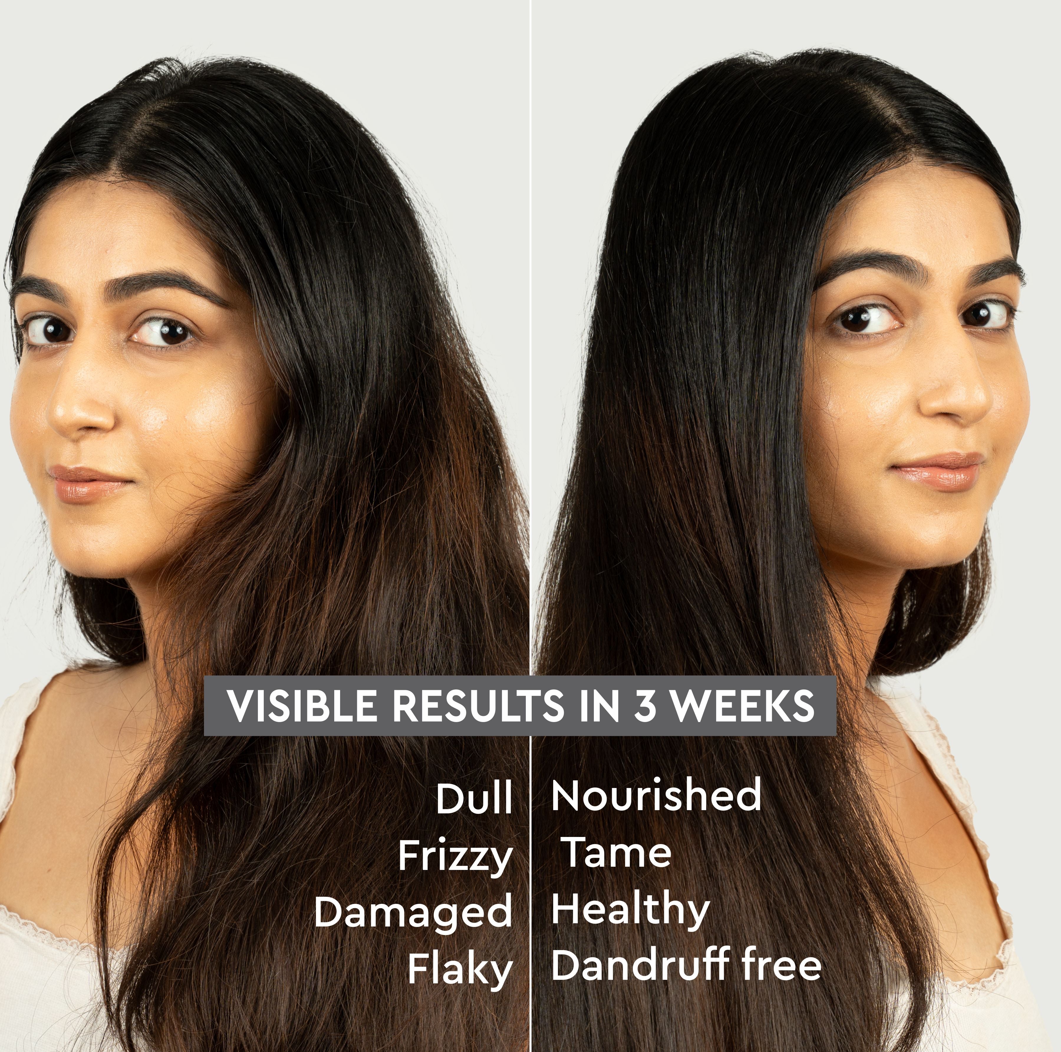 Volumizing Hair Fall Stop Shampoo 200 ml