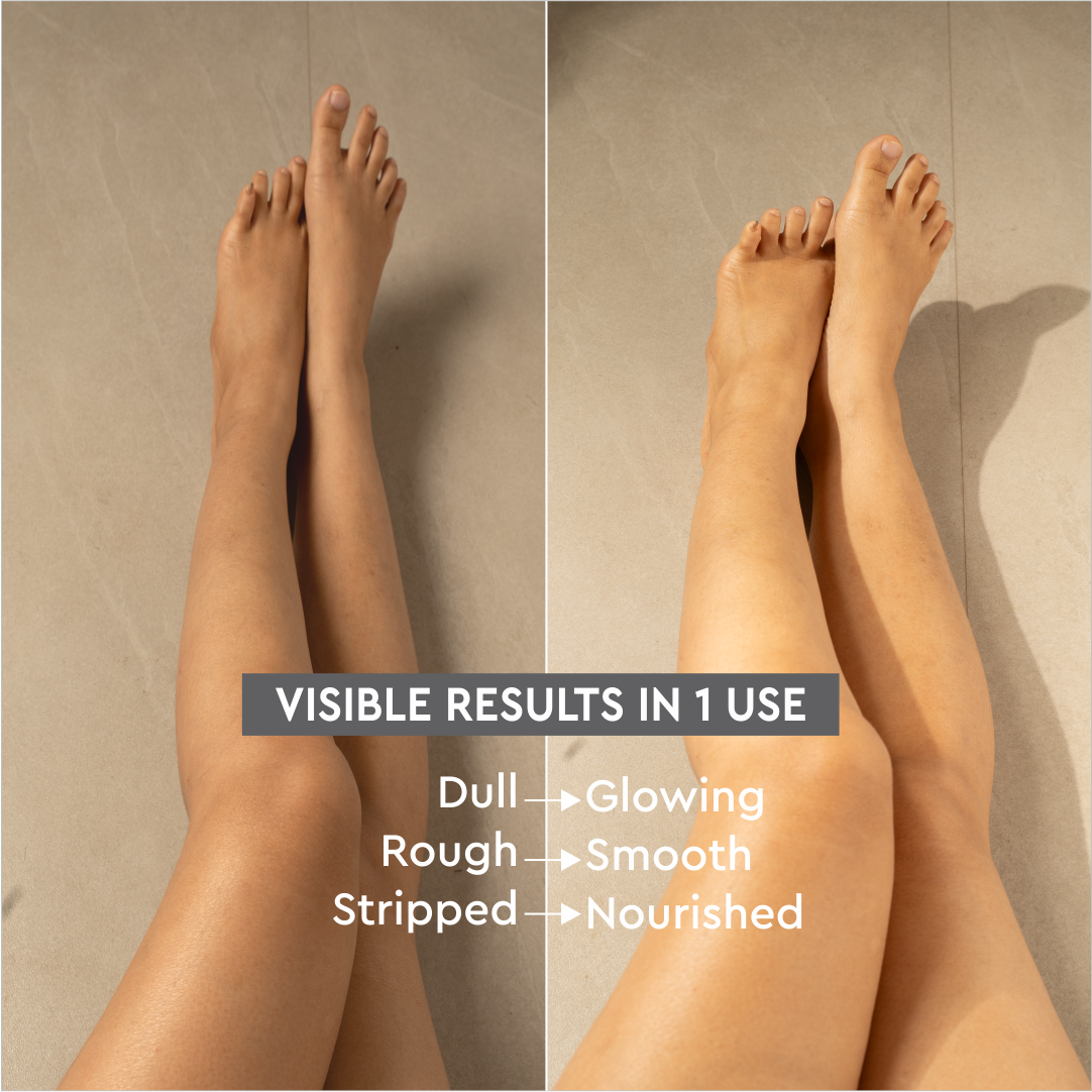 MOISTURIZING Melon Body Butter 150 gm